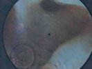 PINK FLOYD - MEDDLE LP PICTURE DISC NUOVO