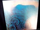 PINK FLOYD MEDDLE CANADIAN COPY GATEFOLD MINT