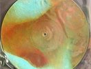 PINK FLOYD MEDDLE LP PICTURE DISC
