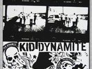 Kid Dynamite - This Is Hardcore Double LP Record Vinyl