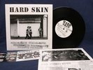 Hard Skin f'n skins 10