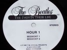 The Beatles: The Days In Their Life-1981 Thirty LP Radi