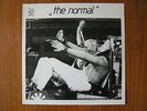 The Normal 