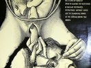 NURSE WITH WOUND - 