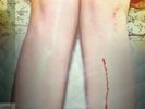 LOS CAMPESINOS**ROMANCE IS BORING**2VINYL