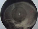 Bill HALEY Bones'n'ribs X-RAY roentgen film roentgenizdat Soviet 1950s record