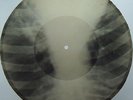 Instumental Jazz Fox Bones'n'ribs X-RAY roentgen film roentgenizdat Soviet 1950s