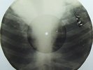 Caravan Benny Goodman Bones'n'ribs X-RAY roentgen film roentgenizdat 1950s USSR