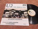 U2 