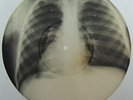 Waltz w. Violin solo X-RAY roentgen film roentgenizdat USSR 1950s bones record
