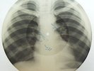 CONSOLINI Non volevo credere X-RAY roentgen film USSR roentgenizdat bones record