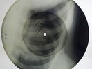 Bones'n'ribs X-Ray Audio roentgen film 50s A. VERTINSKY Jamais (??????? ??????)