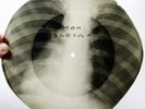 78rpm A. VERTINSKY My Star RARE USSR X-RAY AUDIO ROENTGEN Rib cage Thorax 1950