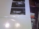 The Beatles white) (goodbye Yellow , dont't shoot me  Elton John)N°3 LP 33