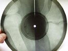 X-Ray 78rpm LESHCHENKO My Gypsy Girl foxtrot RARE USSR ROENTGEN Leg Bones 1950s