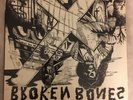 Broken Bones: Crucifix 7