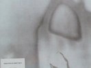 33T.   THE CURE     