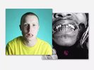 Injury Reserve Floss Live from the Dentist Office Hot Pink Yellow Vinyl /500