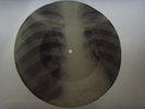Carlos RAMIREZ -I Had To Kiss You X-ray roentgen film bones record