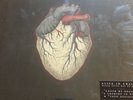 Alice In Chains, Black Gives Way To Blue lp color vinyl, Soundgarden,Pearl Jam