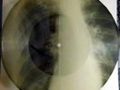 OLD USSR X-RAY RECORD ONE SIDE 78 RPM-Russian song (PETER LESHENKO)