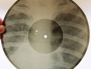 X-Ray 78rpm RAY NOBLE Orchestra Foxtrot Jazz RARE USSR AUDIO ROENTGEN Ribs Bones