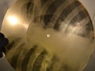 X-RAY 78rpm Besame Mucho (Russian version)  USSR AUDIO ROENTGEN Ribs