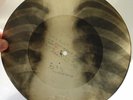 X-Ray 78rpm GLENN MILLER Chattanooga Choo Choo USSR AUDIO ROENTGEN Ribs Bones
