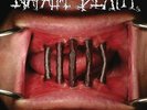 Napalm Death - Coded Smears And More Uncommon Slurs