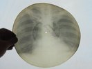Flex 78rpm TRIO LOS PANCHOS Besame mucho Audio-roentgen-record 1950th