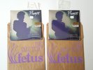 2 x Prince 7” Nothing Compares 2 U Purple Vinyl Sealed