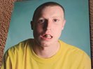 NEW Injury Reserve - Live From the Dentist Office / Floss Vinyl 2xLP