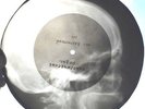 X-RAY 78rpm VERTINSKY Roses USSR RARE AUDIO ROENTGEN Skull