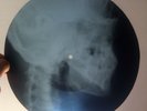 RAY CHARLES - ELEANOR RIGBY - BEATLES COVER - USSR GEORGIAN X-RAY ROENTGEN SKULL