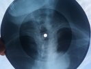 BOB DYLAN - WITH GOD ON OUR SIDE GEORGIAN (EX-USSR) X-RAY ROENTGEN BONES RECORD