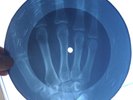 BLACK SABBATH - PARANOID - UNIQUE GEORGIAN USSR X-RAY ROENTGEN HAND BONES RECORD