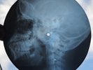 WHO - THE KIDS ARE ALRIGHT - GEORGIAN USSR X-RAY ROENTGEN SKULL BONES RECORD