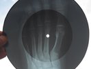 MONKEES - LAST TRAIN TO CLARKSVILLE - GEORGIAN USSR X-RAY ROENTGEN FOOT BONES