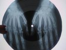 Kinks  You Really Got Me UNIQUE X-RAY USSR ROENTGEN Bones Record