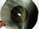 X-Ray 78rpm VERTINSKY sings 