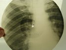 X-Ray 78rpm JOE DANIELS 