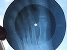 ELVIS PRESLEY - BOSSA NOVA BABY - UNIQUE USSR GEORGIAN X-RAY ROENTGEN RECORD