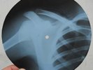 DOORS - LIGHT MY FIRE - UNIQUE USSR GEORGIAN X-RAY ROENTGEN BONES RIBS RECORD