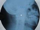 B.B. KING - WOKE UP THIS MORNING  - UNIQUE USSR X-RAY ROENTGEN  SKULL RECORD