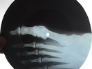 GLENN MILLER - OVER THE RAINBOW - UNIQUE USSR X-RAY ROENTGEN FOOT BONES RECORD