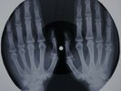 Who - The Seeker X-RAY USSR ROENTGEN Bones Record