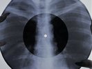 David Bowie – Space Oddity X-RAY USSR ROENTGEN Bones Record