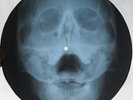 OTTIS REDDING - I'VE BEEN LOVING YOU - USSR GEORGIAN X-RAY ROENTGEN SKULL RECORD