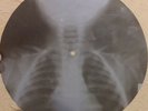 GRATEFUL DEAD - RAIN AND SNOW - USSR GEORGIAN X-RAY ROENTGEN BONES SKULL RECORD