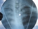 ROLLING STONES - CONNECTION - USSR GEORGIAN X-RAY ROENTGEN RIBS BONES RECORD